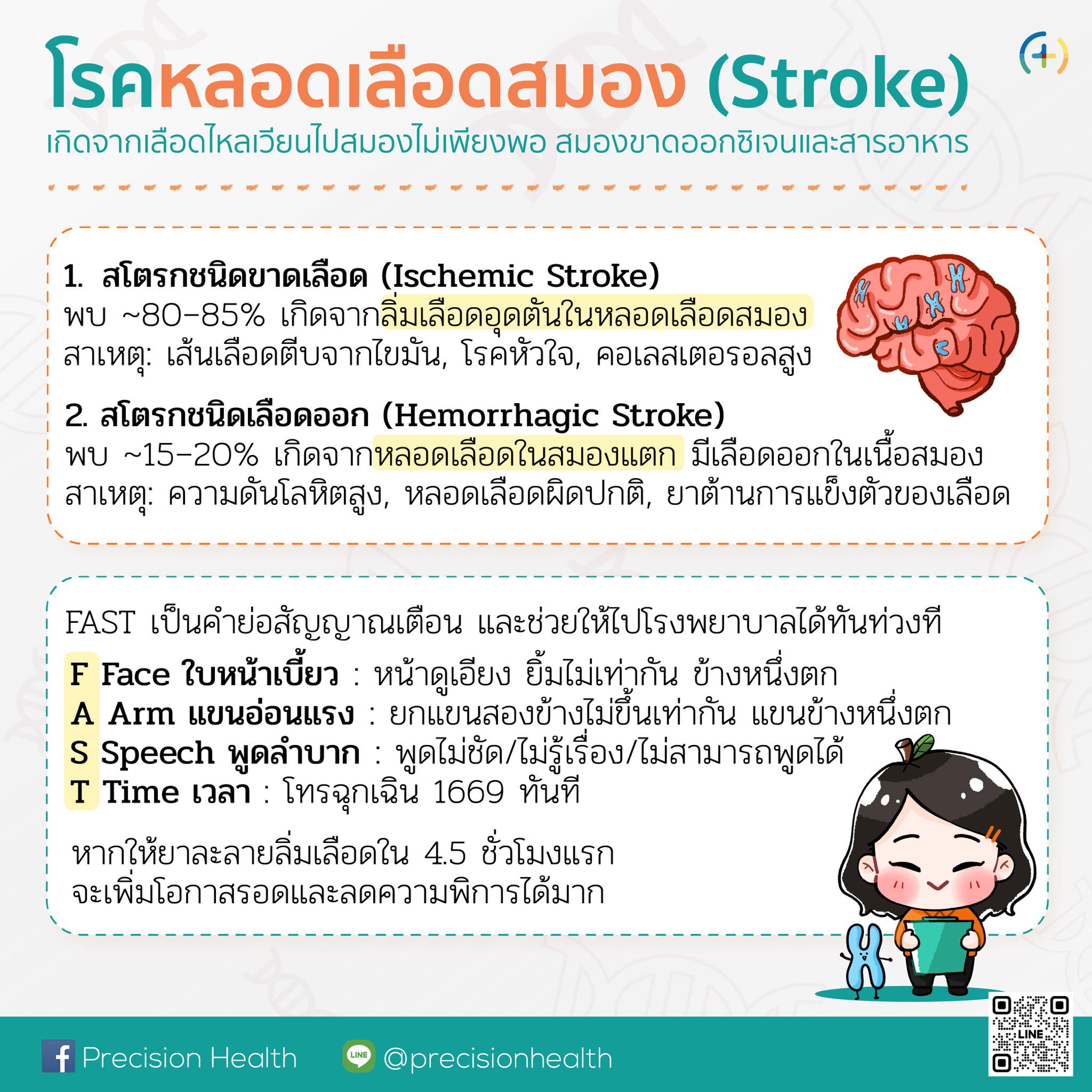 stroke โรคหลอดเลือดสมอง หลอดเลือดสมอง